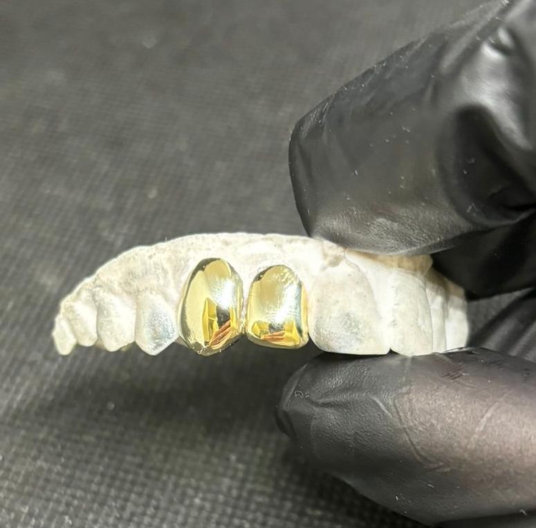 Gold Grillz