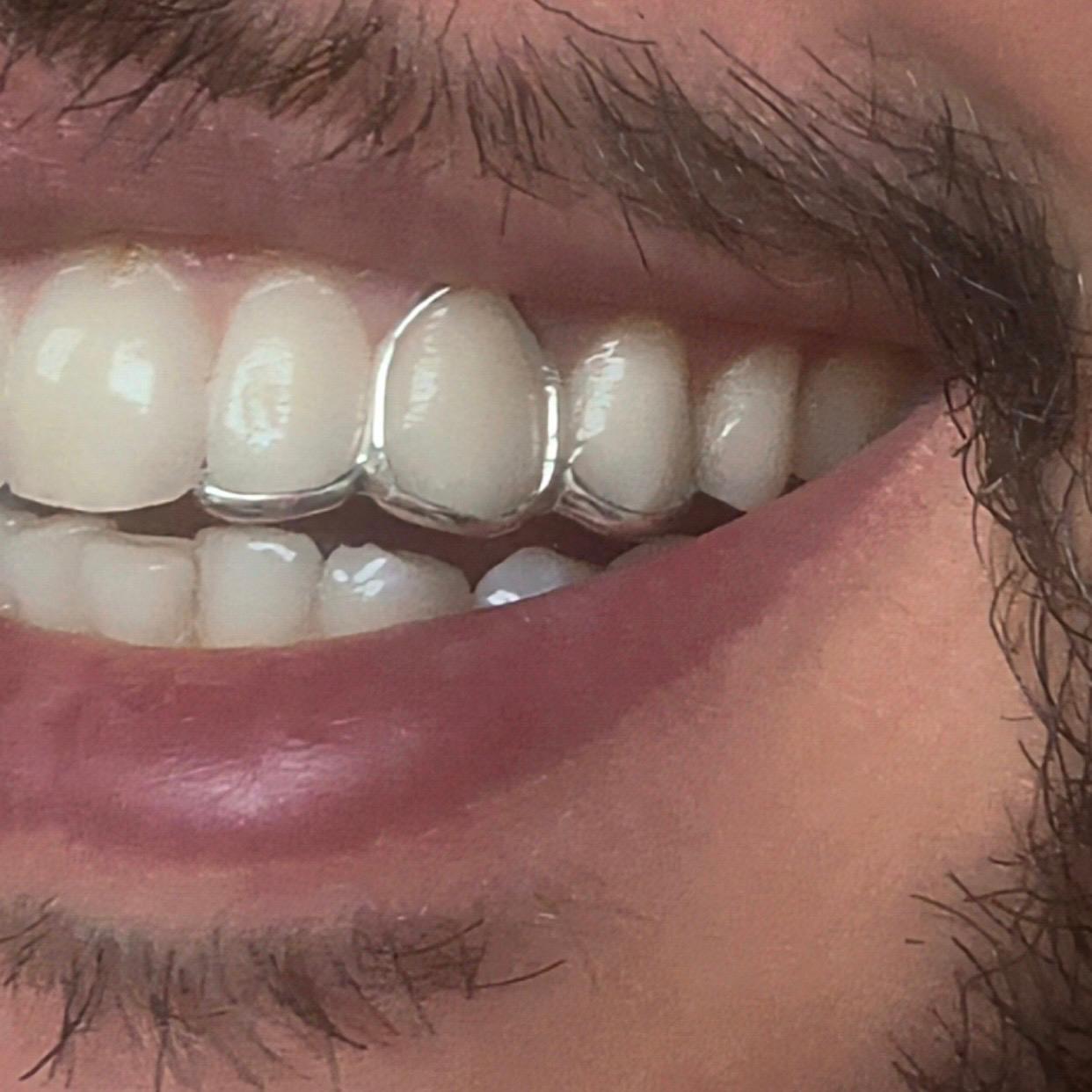 2 Sided Bridge Grillz
