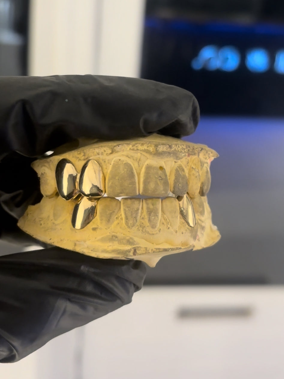 Gold Grillz