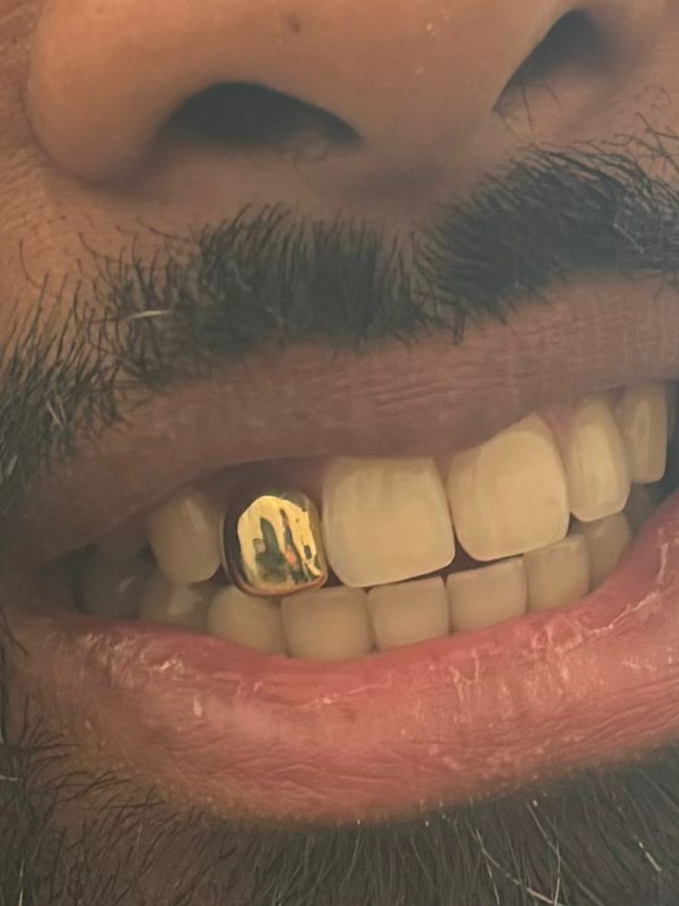 Gold Grillz