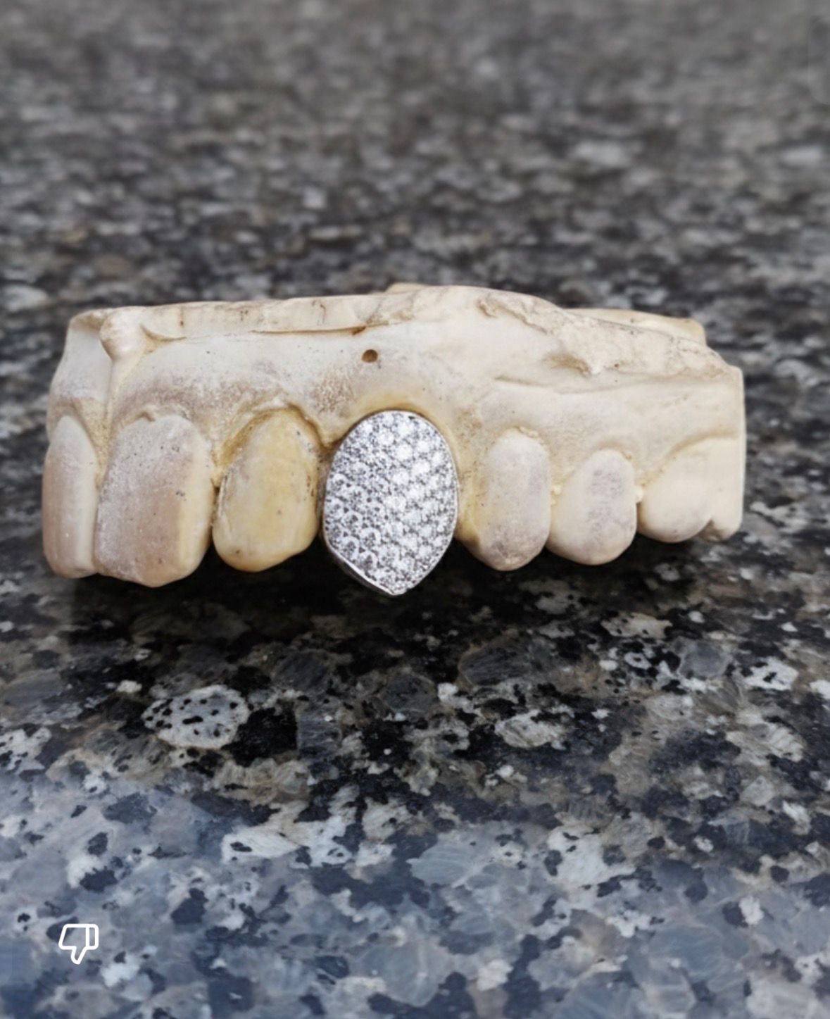 VVS Moissanite Grillz