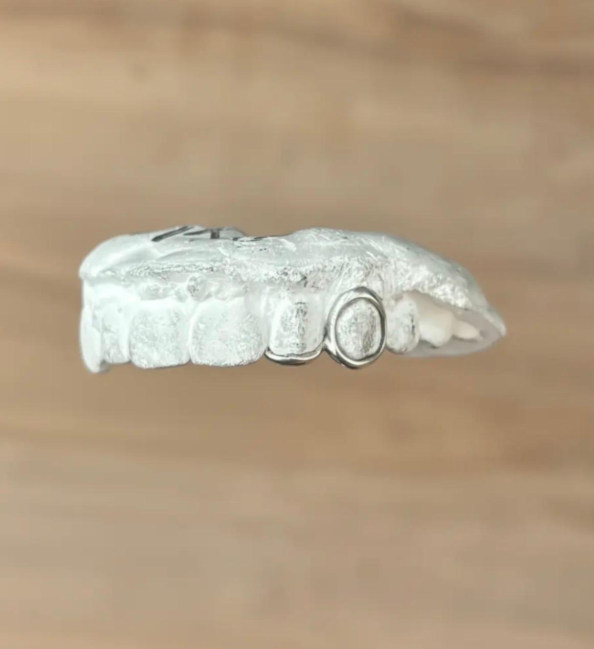 Bridge Grillz