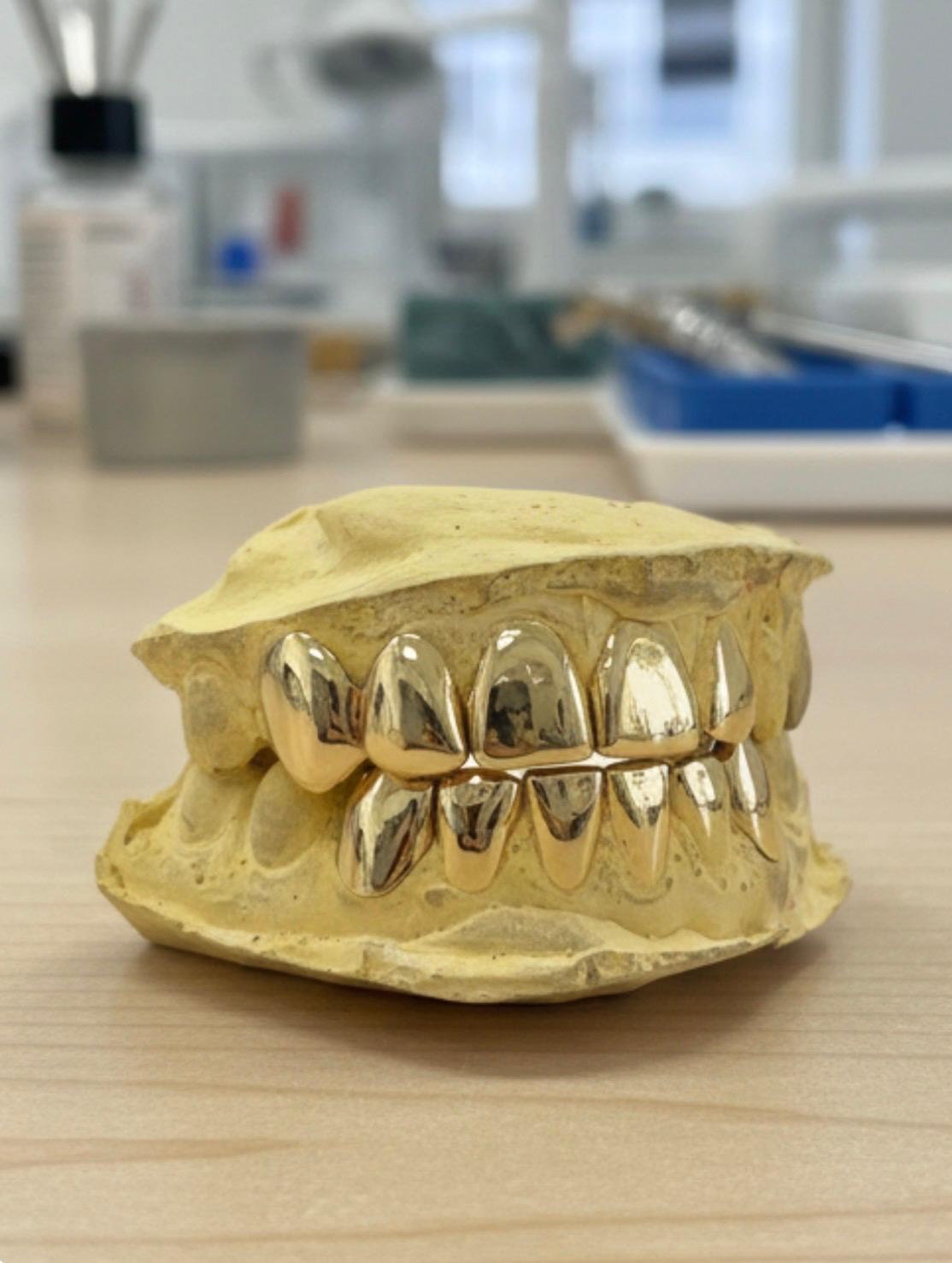 Gold Grillz