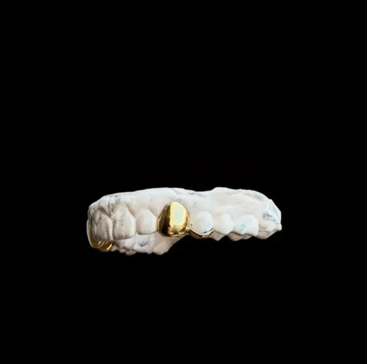 Bridge Grillz